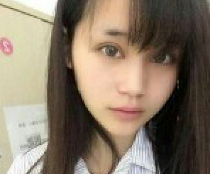 洛陽維多利亞醫(yī)療美容醫(yī)院張樂偉醫(yī)生隆鼻案例:假體隆鼻