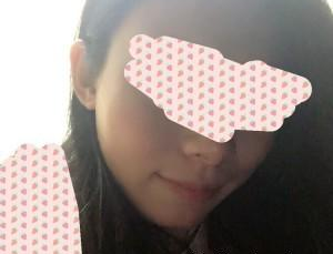 玻尿酸面部填充 讓我更加美麗 - 珍美網(wǎng)