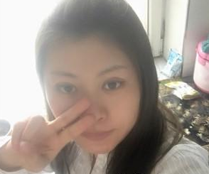 長春南關(guān)區(qū)銘妍醫(yī)療美容部莊璐醫(yī)生割雙眼皮案例:割雙眼皮 - 珍美網(wǎng)