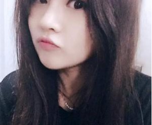 北京蕾士悅醫(yī)療美容診所李長富醫(yī)生豐全臉案例:玻尿酸面部填充
