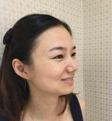 長(zhǎng)沙美研醫(yī)療美容門(mén)診部張彬醫(yī)生瘦臉案例:瘦臉針 - 珍美網(wǎng)
