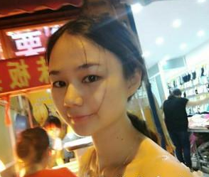 長(zhǎng)沙美研醫(yī)療美容門(mén)診部張彬醫(yī)生瘦臉案例:瘦臉針 - 珍美網(wǎng)