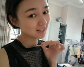 長(zhǎng)沙美研醫(yī)療美容門(mén)診部張彬醫(yī)生瘦臉案例:瘦臉針 - 珍美網(wǎng)
