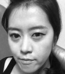北京偉力嘉美信醫(yī)療美容門診部馬永奇醫(yī)生豐全臉案例:成就我的美 - 珍美網(wǎng)