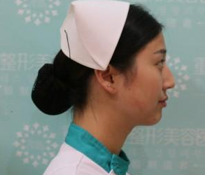 重慶星宸美容醫(yī)院彭紹宗醫(yī)生鼻部綜合整形案例:我的小翹鼻 - 珍美網(wǎng)