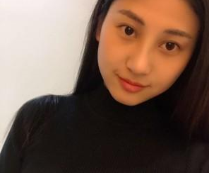 重慶星宸美容醫(yī)院彭紹宗醫(yī)生鼻部綜合整形案例:我的小翹鼻 - 珍美網(wǎng)