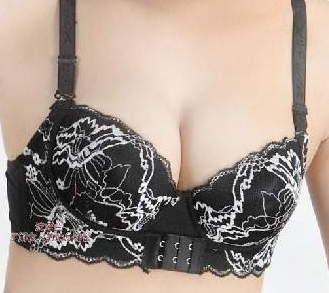 乳頭內(nèi)陷矯正術(shù)出現(xiàn)后遺癥應(yīng)該怎樣處理 - 珍美網(wǎng)