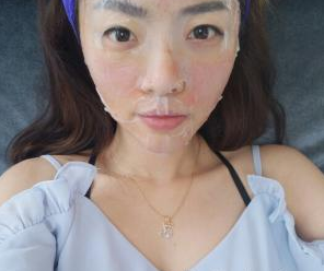 水光針嫩膚 讓我可以這么美美噠 - 珍美網(wǎng)