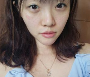水光針嫩膚 讓我可以這么美美噠 - 珍美網(wǎng)