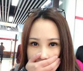 雙眼皮手術(shù) 眼睛更加迷人好看 - 珍美網(wǎng)