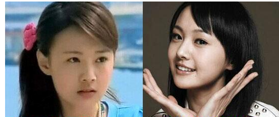 鄭爽為愛整容 但還是個(gè)很受人喜愛的女演員 - 珍美網(wǎng)