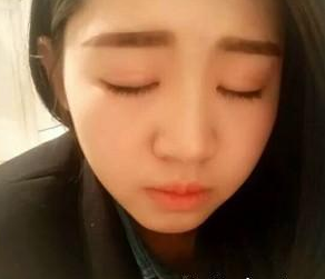 割雙眼皮 脫單不是問題美的不要不要的