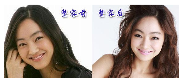 自爆宋鐘基女友是真是假 但整過的臉就不假了