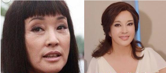 劉曉慶整容前后照片 62歲不服老的精神，依舊“少女”