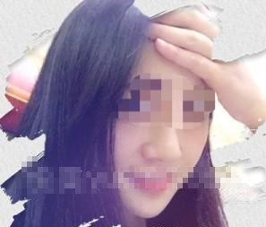 玻尿酸豐下巴 全新的我真好看