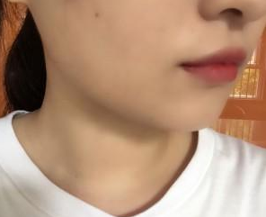 瘦臉針 讓男人目不轉(zhuǎn)睛的氣質(zhì)女 - 珍美網(wǎng)