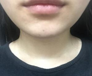 瘦臉針 讓男人目不轉(zhuǎn)睛的氣質(zhì)女