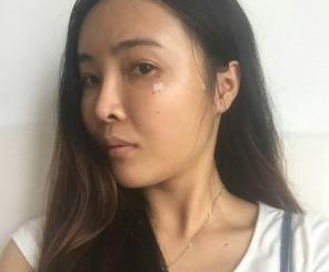 自體脂肪填充  重新找回美麗動(dòng)人的我 - 珍美網(wǎng)