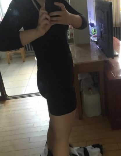 吸脂減肥 婀娜多姿的身材我也可以擁有 - 珍美網(wǎng)