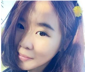 玻尿酸隆鼻 擁有俏麗的鼻子真美麗 - 珍美網(wǎng)