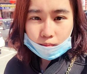 玻尿酸隆鼻 擁有俏麗的鼻子真美麗 - 珍美網(wǎng)