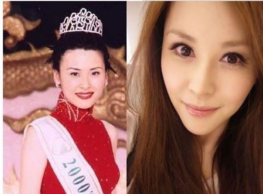 穆熙妍整容前后 億萬千金讓蔡康永都驚訝 - 珍美網(wǎng)