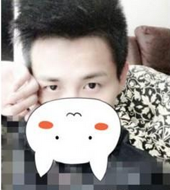 鄭州麗天醫(yī)療美容門診部陳紅燕醫(yī)生割雙眼皮案例:割雙眼皮+開眼 - 珍美網(wǎng)