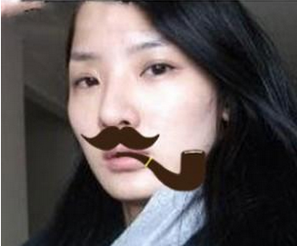 玻尿酸多部位面部填充 重現(xiàn)年輕美貌精致的自己 - 珍美網(wǎng)