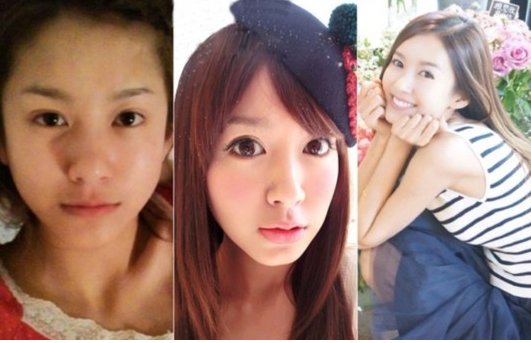 張子萱整形對比照 跟陳赫奉子成婚“辣媽”誕生 實現(xiàn)事業(yè)愛情雙豐 - 珍美網(wǎng)