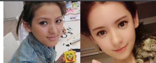 王思聰前女友張予曦整容前后對比 事業(yè)愛情雙豐收 - 珍美網(wǎng)