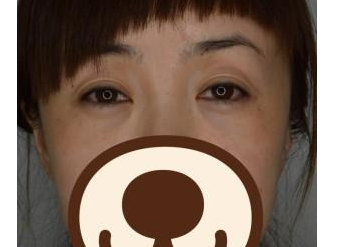 半永久紋眼線  讓我重現(xiàn)光彩明亮的眼睛 - 珍美網(wǎng)