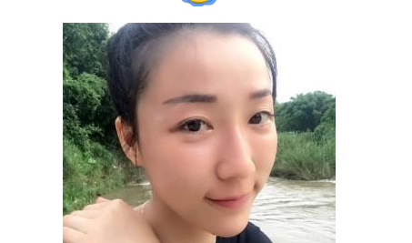 豐全臉手術(shù)  讓我膠原蛋白滿滿光彩照人