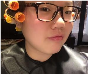 玻尿酸注射隆鼻 讓我找回美麗的自信 - 珍美網(wǎng)