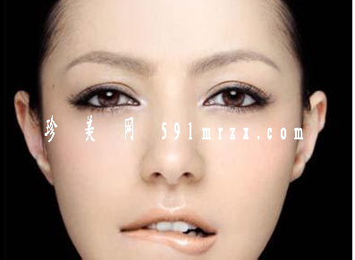 韓式雙眼皮效果自然嗎 - 珍美網(wǎng)