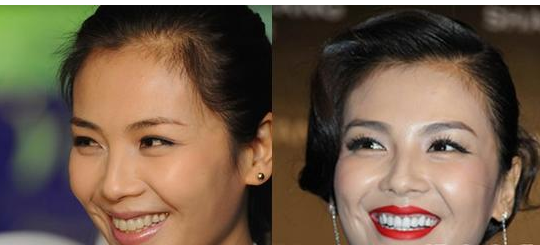 劉濤整形了嗎? 那么如何顏值逆襲了 - 珍美網(wǎng)