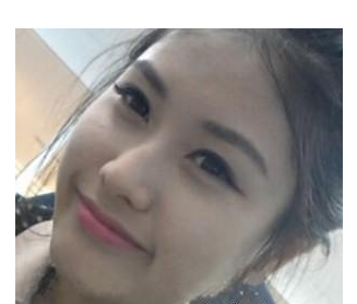 假體隆鼻 實(shí)現(xiàn)更加美麗動(dòng)人的自己 - 珍美網(wǎng)