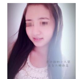 注射瘦臉針 小v臉值得擁有 - 珍美網(wǎng)