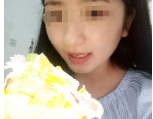 注射瘦臉針  小v臉值得擁有
