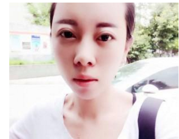割雙眼皮手術(shù) 大眼睛真的好迷人啊 - 珍美網(wǎng)