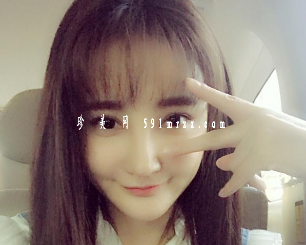 劉雨欣整形了嗎？ 網(wǎng)友驚呼變臉認(rèn)不出 - 珍美網(wǎng)