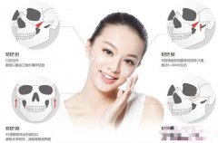 磨骨和削骨有什么區(qū)別?哪個風(fēng)險大?