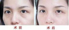 上海填淚溝多少錢？?jī)r(jià)格是多少？