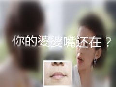 【整形常識】墊下巴婆婆嘴多久消失？