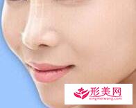 怎么選擇適合的隆鼻方法