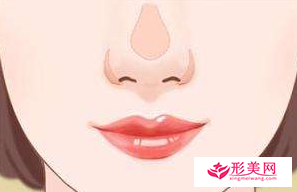 做鼻頭縮小手術(shù)要多少錢