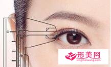 全切雙眼皮術(shù)后會有血腫嗎
