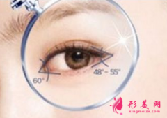 做開眼角手術(shù)要花多少錢？