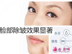 膠原蛋白除皺_膠原蛋白除皺的禁忌人群