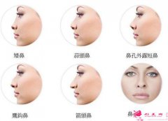 影響玻尿酸隆鼻整形價格的要素有幾種？