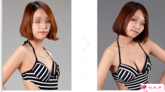 假體隆胸后的護(hù)理 假體隆胸后該如何按摩乳房？